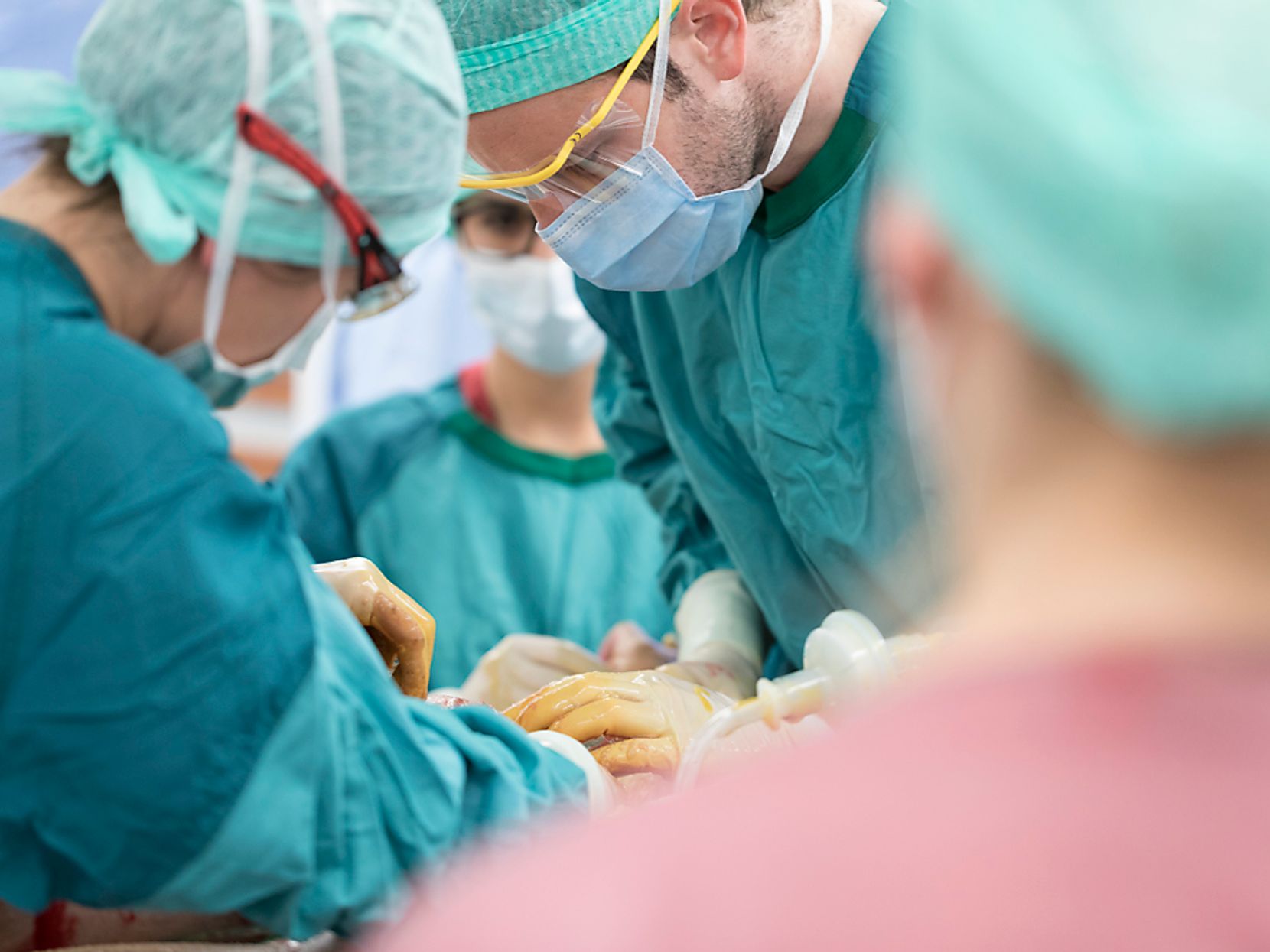 Man sieht mehrere Ärzte und Krankenhauspersonal in grüner Berufskleidung und mit Mundmasken bei einer Operation.